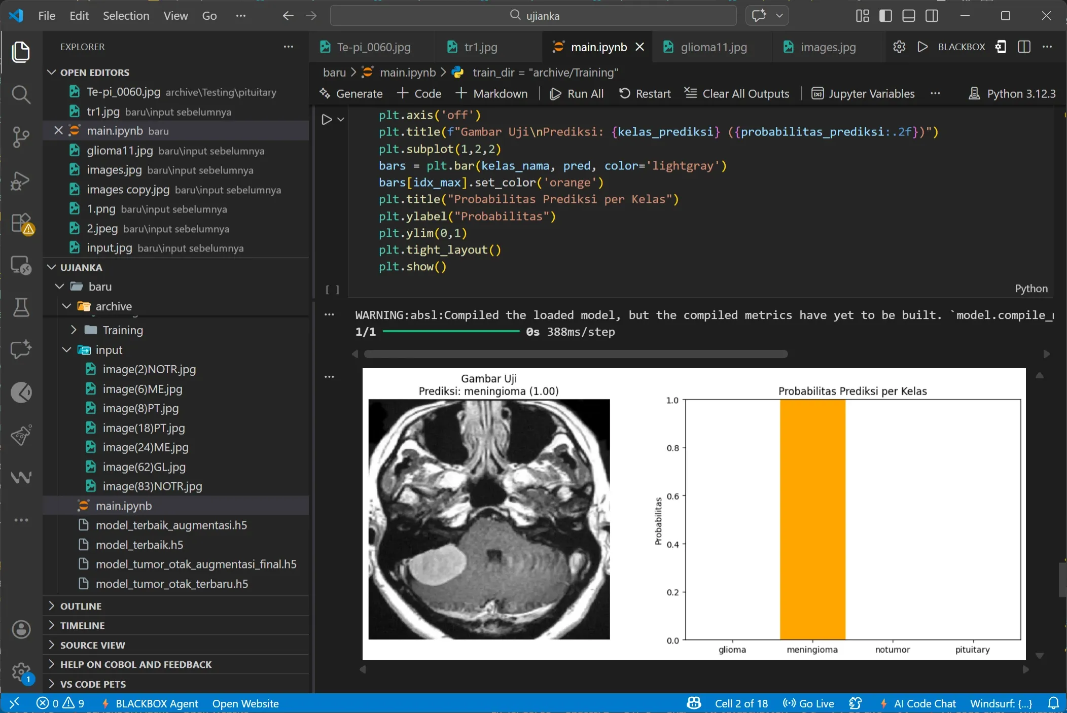 Brain Tumor Detection